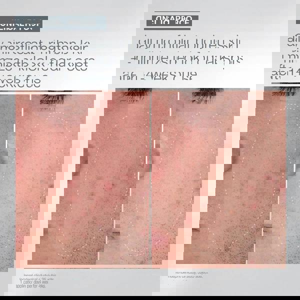 Dermalogica Let It Glow