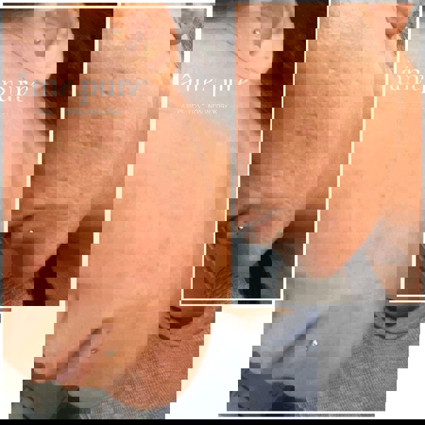 Âme Pure CIT FACE ROLLER PLATINUM - Microneedling Derma Roller Kit