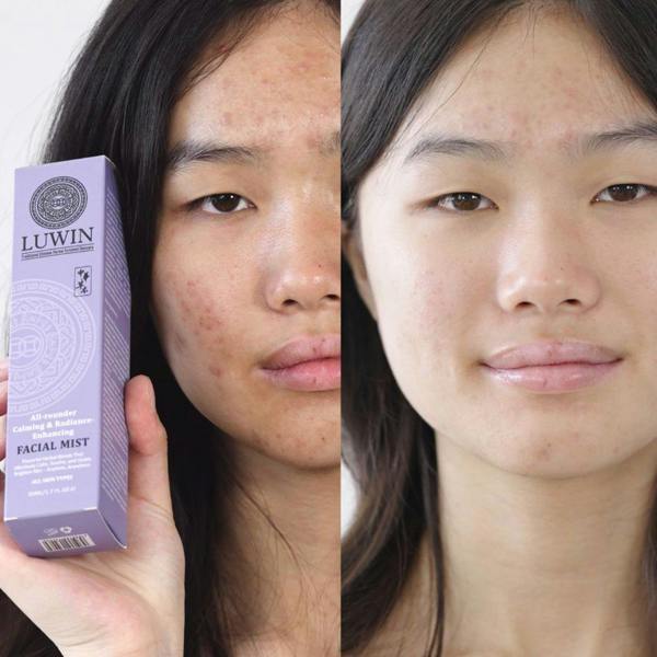 Luwin All-Rounder Calming & Radiance-Enhancing Facial Mist