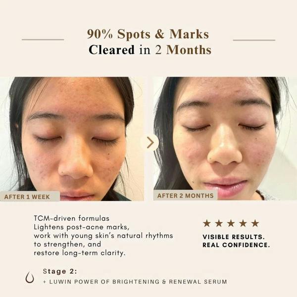 LUWIN Skincare Advanced Clear & Brightening Super Set – Acne & Dark Spot Routine for Clear, Even Skin | LUWIN