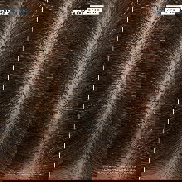 Philip Kingsley Flaky/Itchy Scalp Hydrating Curl Anti-Dandruff Shampoo