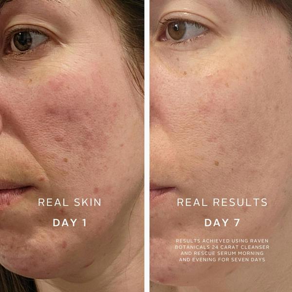 Raven Botanicals Rescue Serum