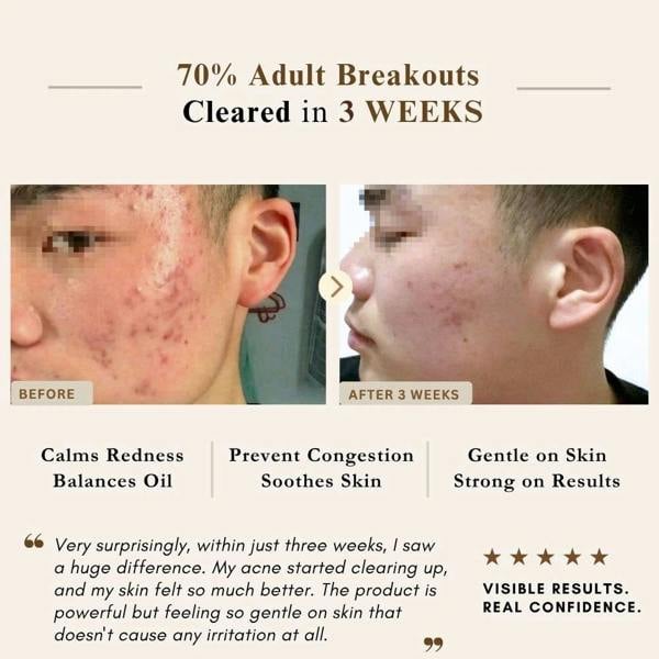 LUWIN Skincare Advanced Clear & Brightening Super Set – Acne & Dark Spot Routine for Clear, Even Skin | LUWIN