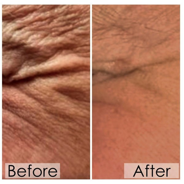 elixir SK9 bio-serum