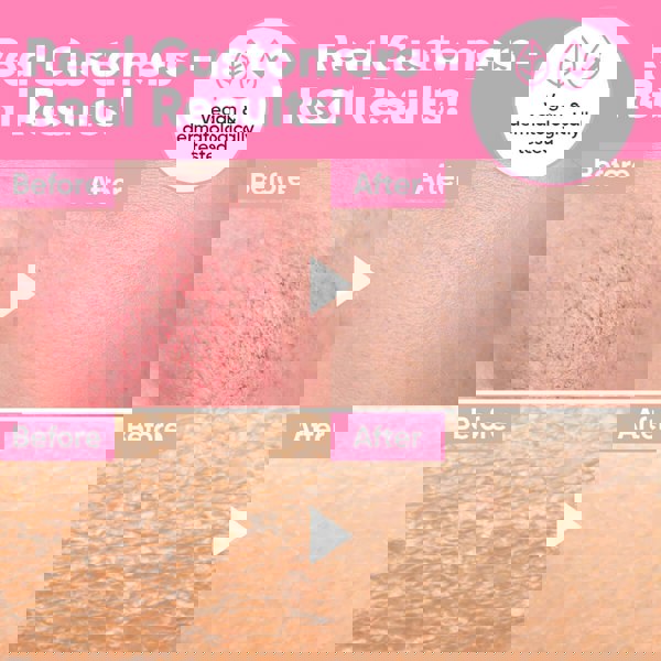 Âme Pure DON’T BE THIRSTY – Deeply Hydrating Face Serum With Peptides